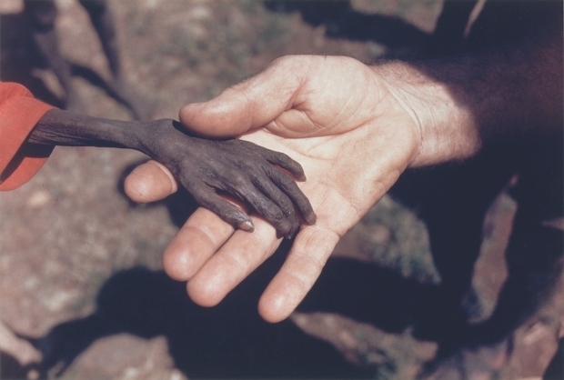 1980: Υποσιτισμένο παιδί στην Ουγκάντα