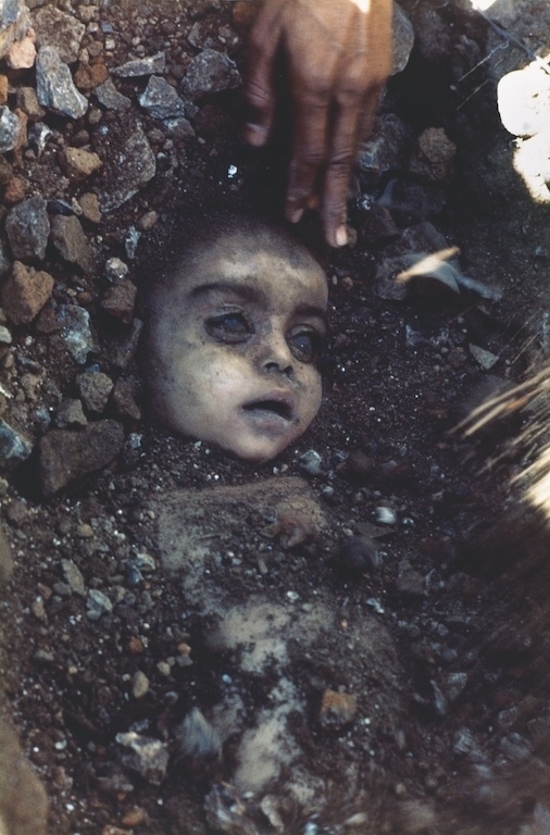1984: Νεκρό παιδί από δηλητηριώδη διαρροή αερίου σε χημικό εργοστάσιο της Union Carbide.