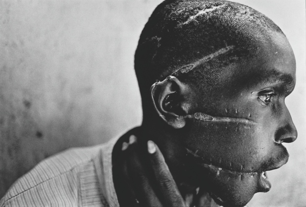 1994: Χαρακωμένος άνδρας από την πολιτοφυλακή «Interahamwe» του Χούτου (Hutu), επειδή θεωρήθηκε ότι διάκειται ευνοϊκά προς τους αντάρτες Τούτσι.