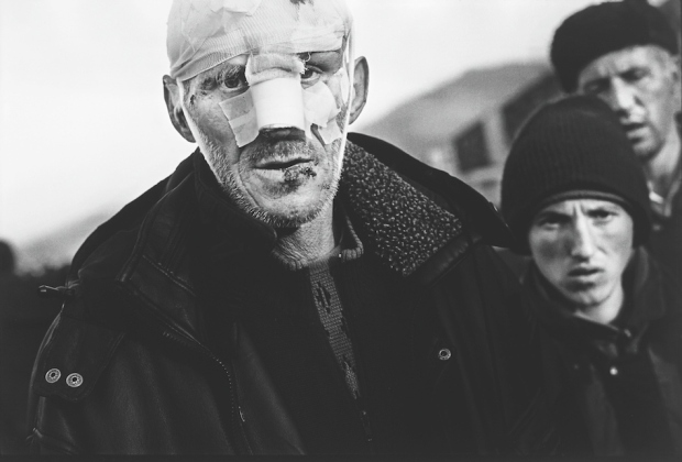 1999: Ένας άνδρας περπατά στους δρόμους ενός από τους μεγαλύτερους καταυλισμούς για Αλβανούς πρόσφυγες από τις μάχες στο Κοσσυφοπέδιο.